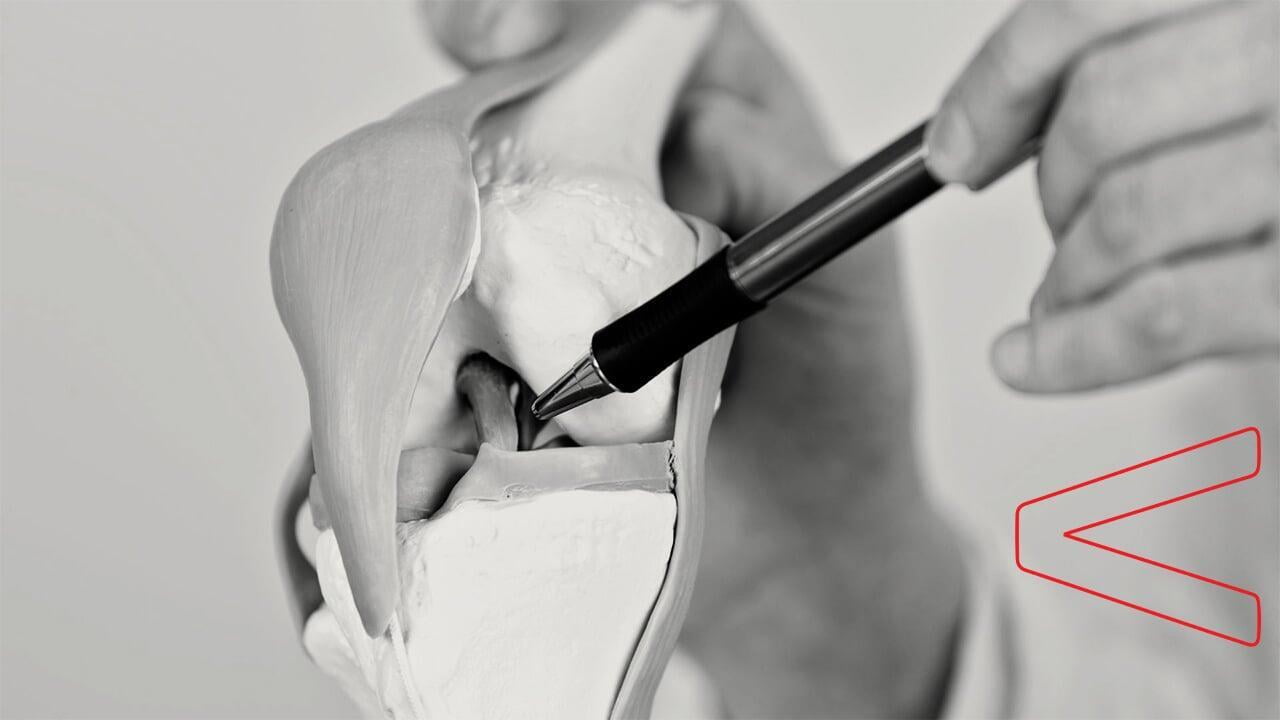 Anterior Cruciate Ligament.jpg